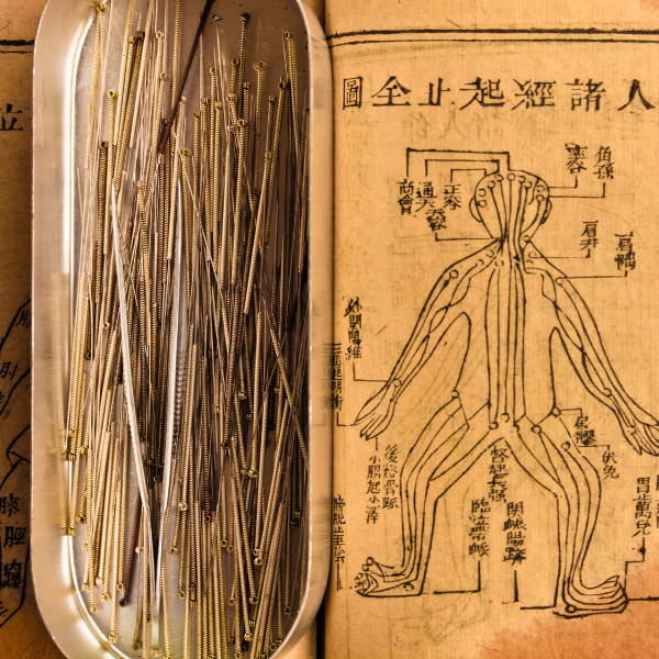 Conventional acupuncture treatment using needles to stimulate energy channels