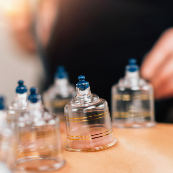 During a cupping therapy session at Ancient Auras, suction cups are applied to the back