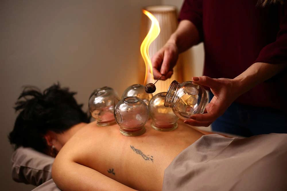 sports cupping therapy